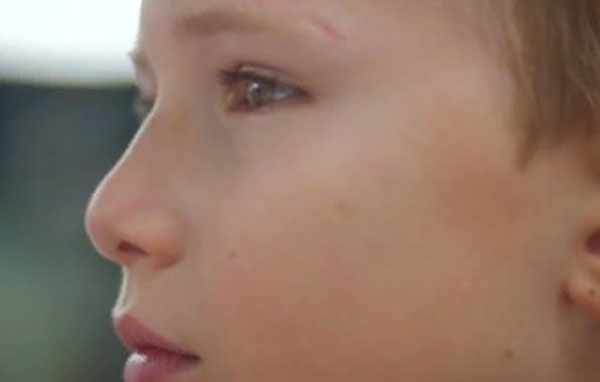 Лицо мальчика со шрамом над бровью