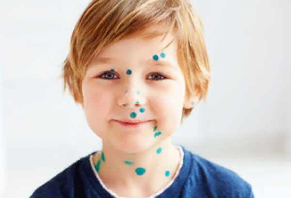 Ребенок с зелеными цяточками на лице и шее