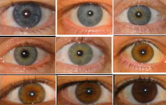 Глаза разного цвета