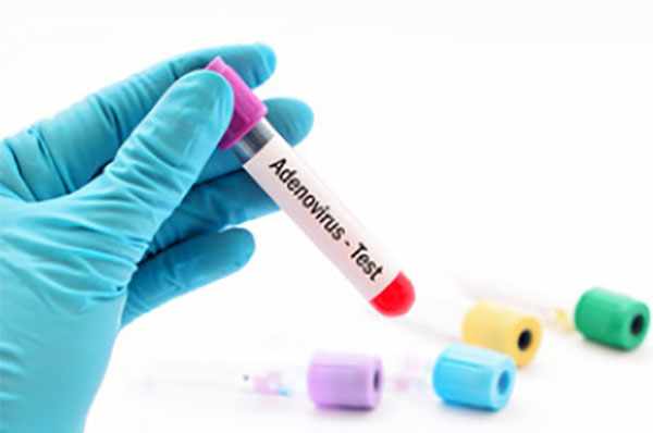 Пробирка с кровью - тест на аденовирусы