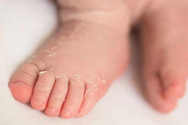 Ножки маленького ребенка с шелушением кожи
