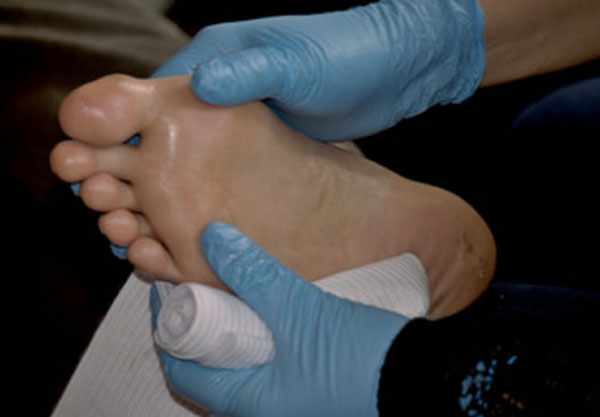 Перелом большого пальца на ноге