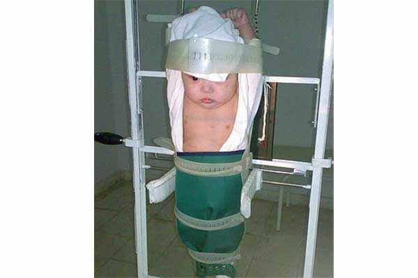 Четырехмесячный малыш зафиксирован в подвешенном состоянии. Надета защита. Голая грудная клетка - область проведения снимка