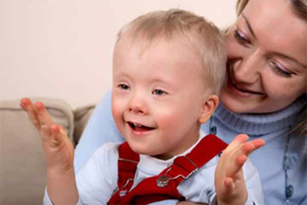 Ребенок с синдромом Дауна у мамы на руках